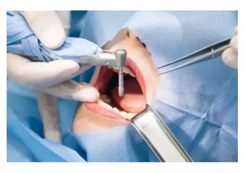 Dental Implants Penrith