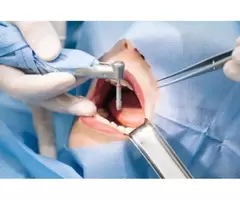 Dental Implants Penrith