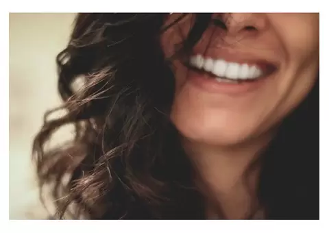 High-Quality Dental Veneers in Box Hill