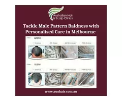 Tackle Male Pattern Baldness with Personalised Care in Melbourne