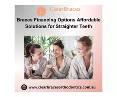 What Are Ceramic Braces Benefits of Clear Orthodontics
