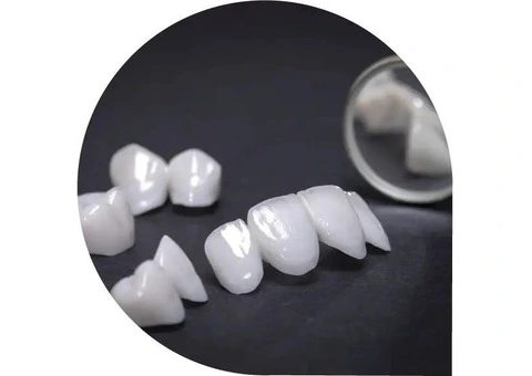 Quality Dental Services at Pyrmont Dental Centre - 4/4