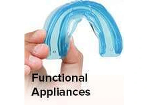 Tooth Implant Cost Explained Best Value for Your Smile