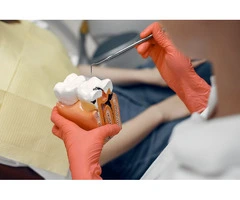 Looking for Dental Implants in Box Hill?