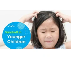 Managing Dandruff in Younger Children with Trusted Childcare in Dayton