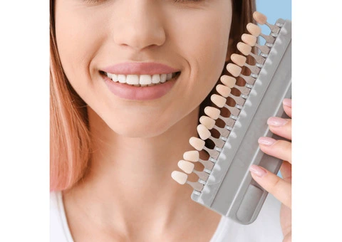 Enhance Your Smile with Dental Composite Veneers in Chatswood