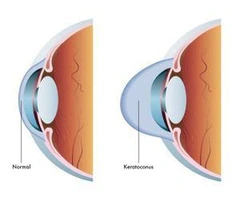 Achieve Better Vision With the Best Eye Specialists in Melbourne
