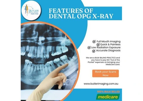 Features of Dental OPG X-Ray at Butler Medical Imaging.(08) 9544 3999