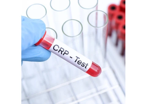 Know about CRP blood test