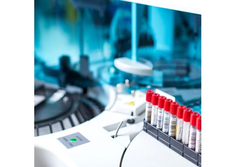 What is a creatinine blood test?