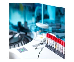 What is a creatinine blood test?