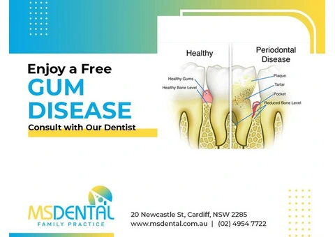 Gum Disease Treatment‎ Newcastle Cardiff - MS Dental