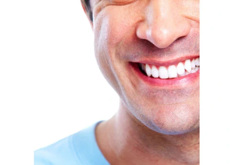 Brighten Your Smile with LED Teeth Whitening – Miami Kiss International