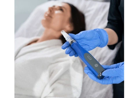 Microneedling Sydney