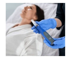 Microneedling Sydney