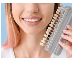 Dental Veneers in North Shore