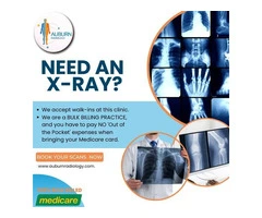 Need an X-ray? Visit us at Auburn Radiology for fast, accurate imaging services.