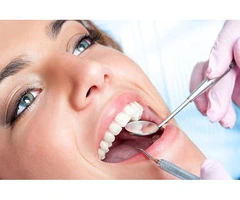 Best Dentist for Veneers Canberra