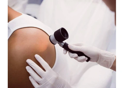 Get the Best Skin Cancer Treatment in Kalgoorlie