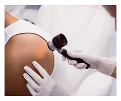 Get the Best Skin Cancer Treatment in Kalgoorlie