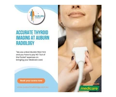 Accurate Thyroid Imaging at Auburn Radiology. (02) 8315 8292