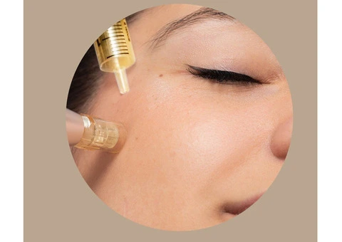 Prp Injections Sydney