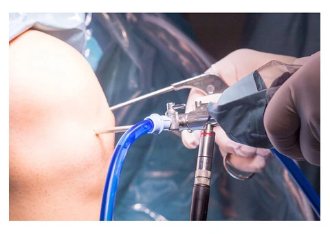 Knee Arthroscopy Surgery Restores Joint Function Effectively