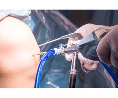 Knee Arthroscopy Surgery Restores Joint Function Effectively