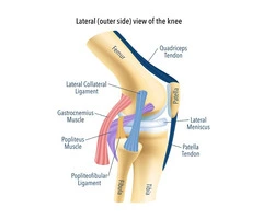 Treat Joint Discomfort with Knee Reconstruction Surgery