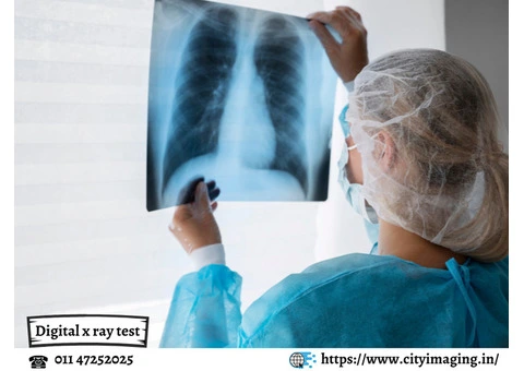 X Ray Price Guide: Find Affordable Rates Near You