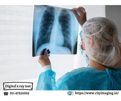 X Ray Price Guide: Find Affordable Rates Near You