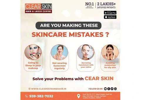 facial port wine stain Treatment in india