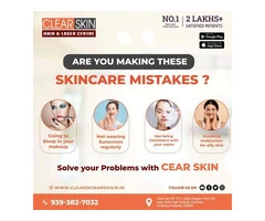 facial port wine stain Treatment in india