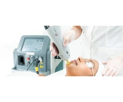 Say Goodbye to Shaving with Full Face and Neck Laser Hair Removal Today