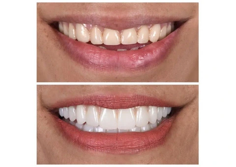 Cosmetic Dentist Melbourne | My implant Dentist