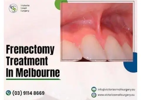 Get Expert Frenectomy Treatment in Melbourne – Book Your Appointment Today