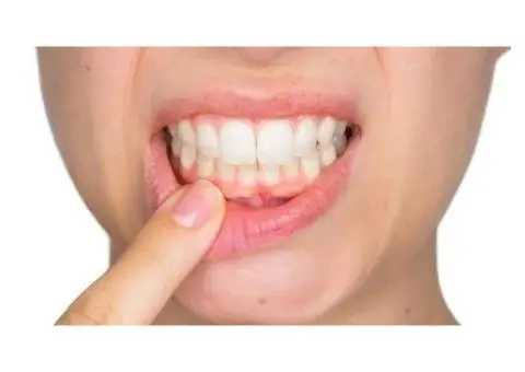 Trusted Family & Cosmetic Dentist | Supreme Dental Cowes - 6/8