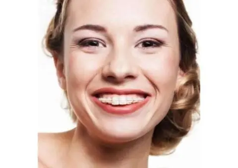 Trusted Family Dentist in Lalor | Supreme Dental Lalor - 2/6