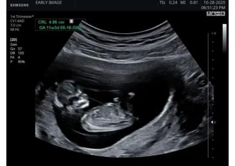 Feeling Anxious? Connect with Your Baby Instantly with Our 24/7 Reassurance Scan
