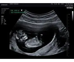 Feeling Anxious? Connect with Your Baby Instantly with Our 24/7 Reassurance Scan