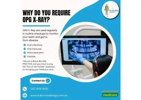 Why Do You Need an OPG X-Ray? at Crystal Radiology in Auburn. (02) 8315 8292