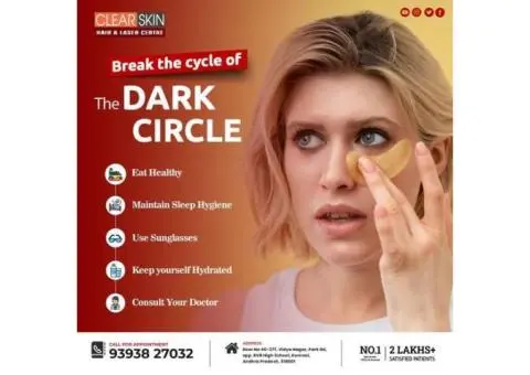 PRP hair Treatment in india