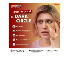 PRP hair Treatment in india