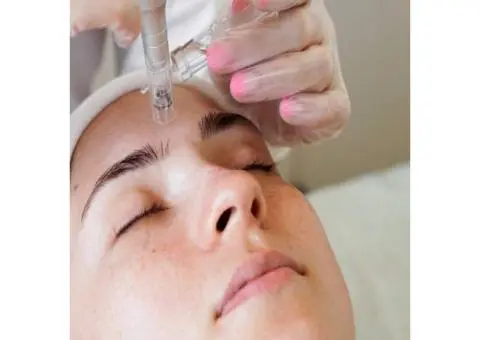 Best Microneedling in Beecroft – Armitage Skin & Laser Clinic