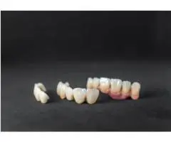Dental Crowns Willoughby