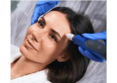 Skin Needling Sydney