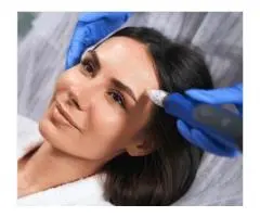 Skin Needling Sydney