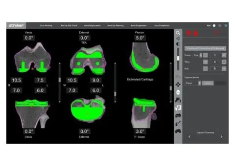 How Can Robotic Partial Knee Replacement Surgery Benefit You?