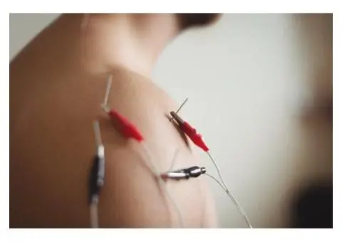 Acupuncture Perth | The On Acupuncture TCM Care
