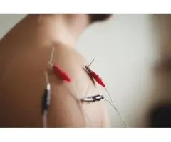 Acupuncture Perth | The On Acupuncture TCM Care